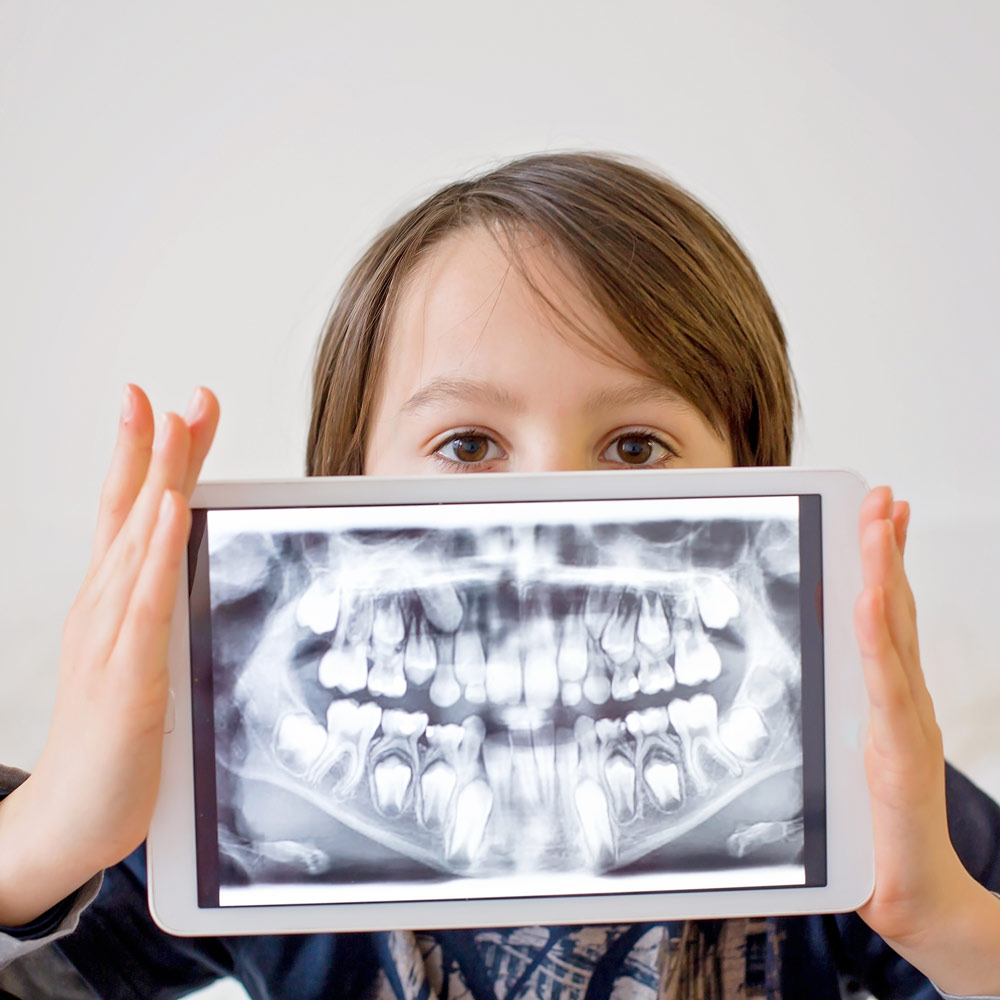 doctor holding X-ray