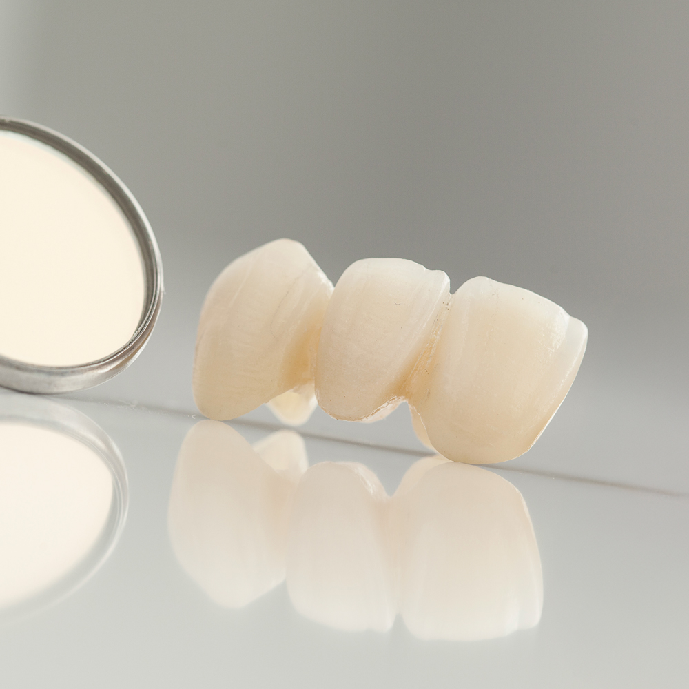 dental bridges on surface