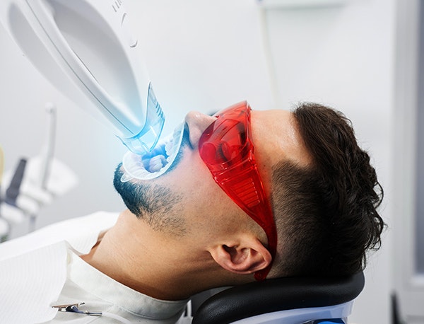 man receiving teeth whitening