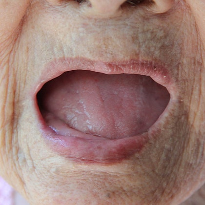 mature person missing all their teeth