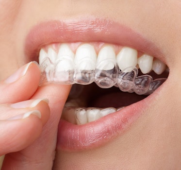 Person placing Invisalign