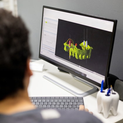 Digital dental scans