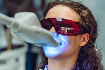woman getting her teeth professionally whitened
