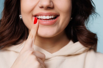 Woman pointing to her gums