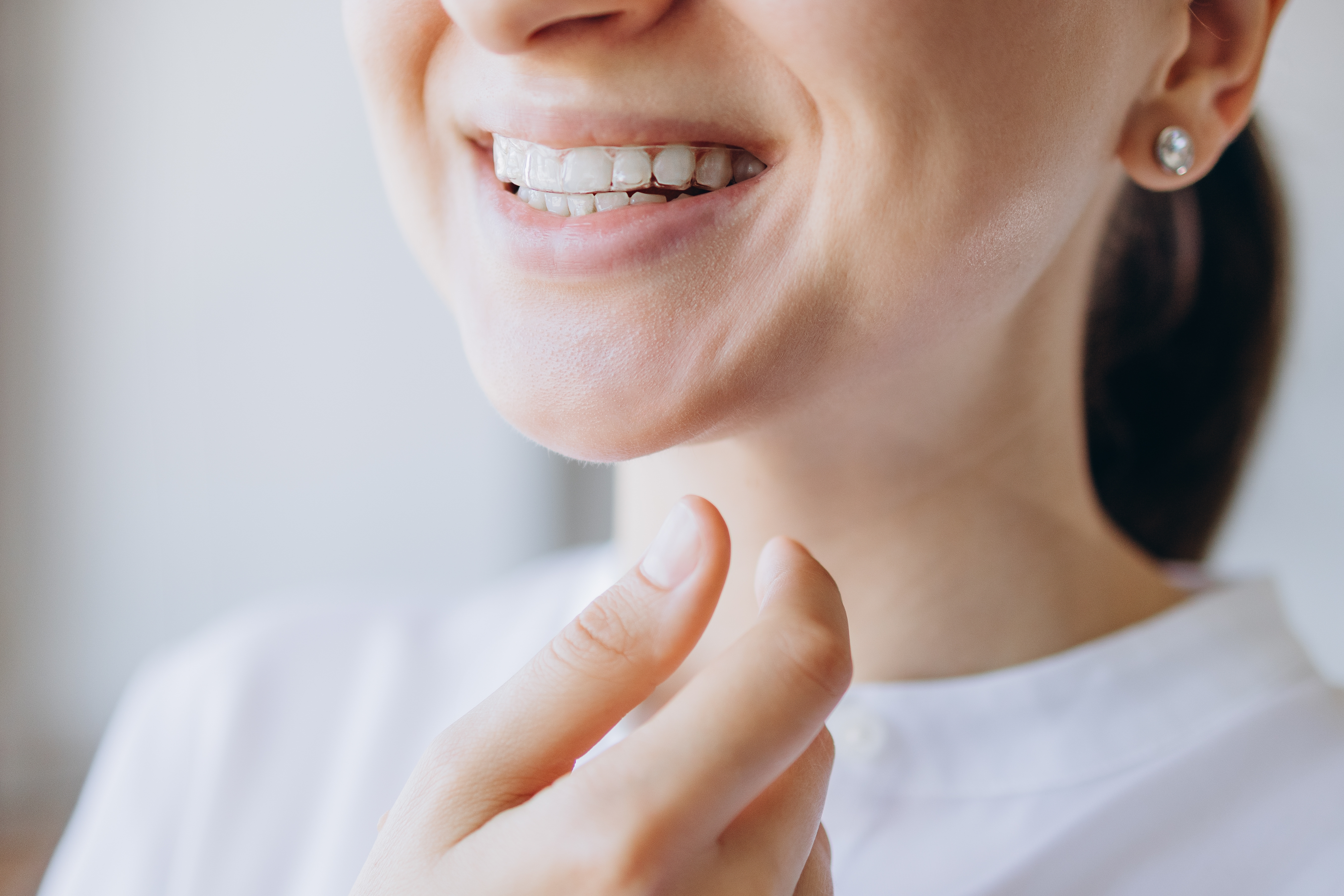 Woman smiling with aligner tray 