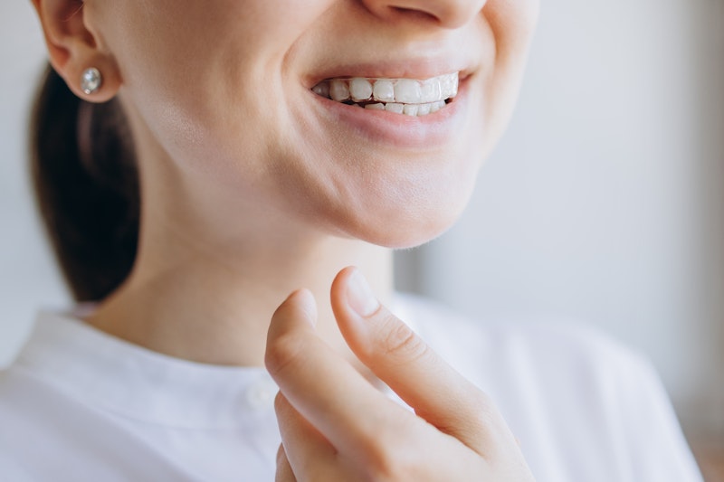 Woman smiling with aligner tray 