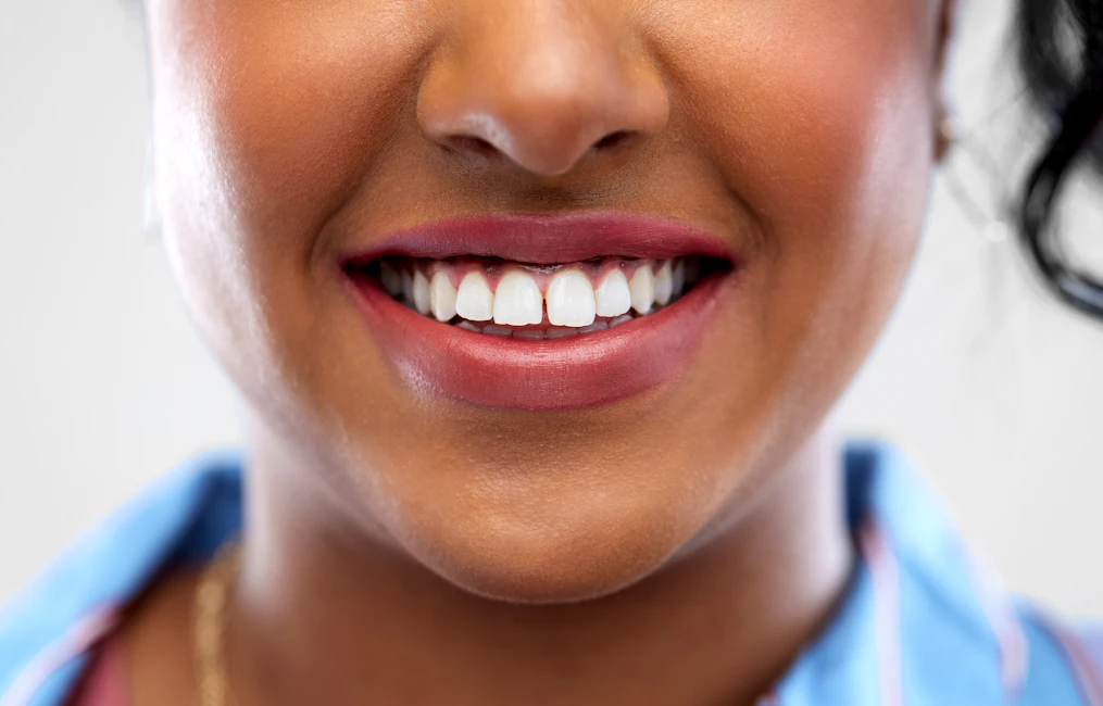 woman with tooth gap