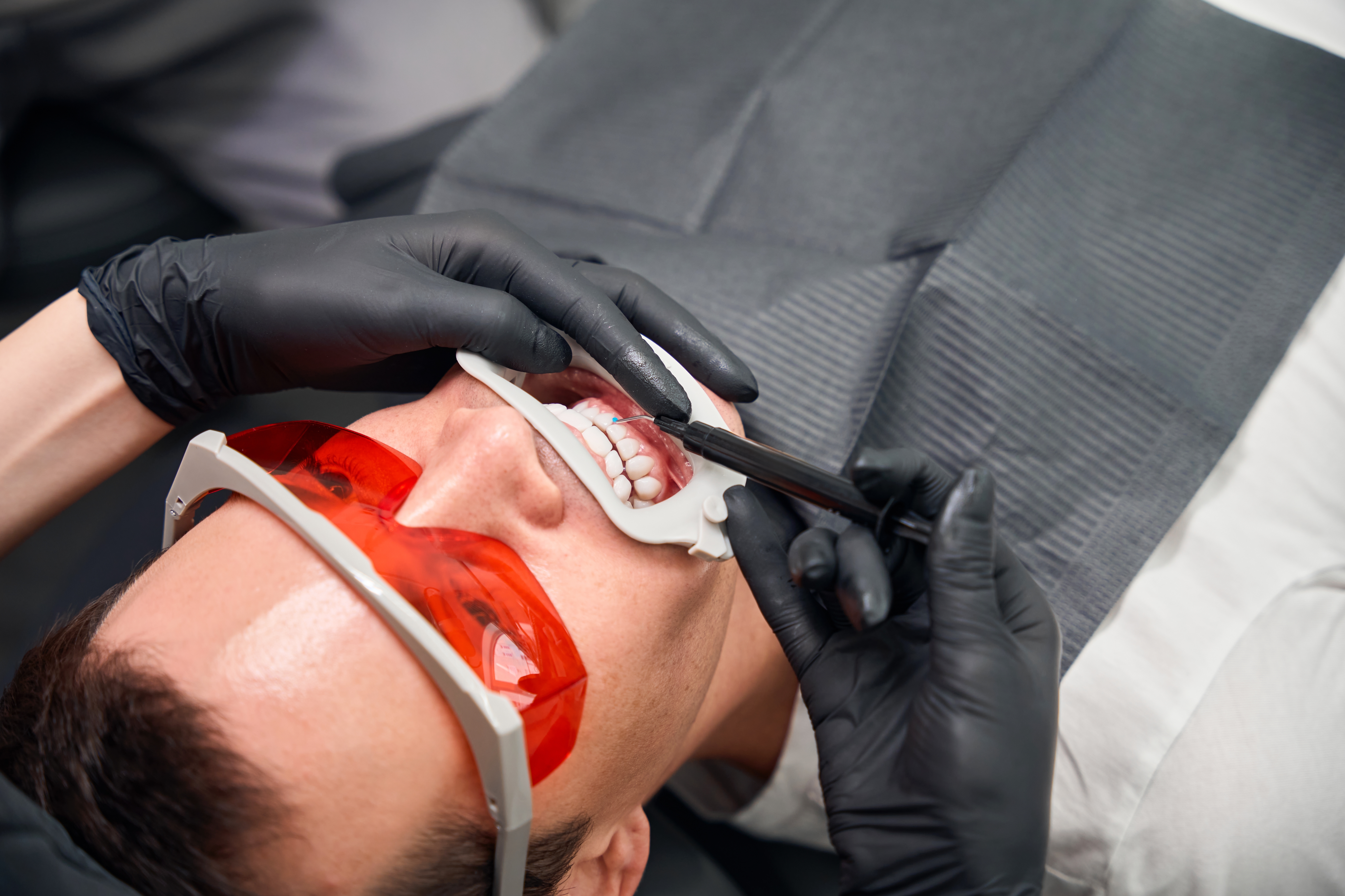man receiving teeth whitening
