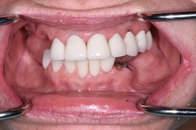 Before dental treatment