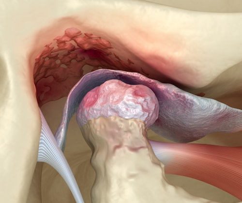 Jaw joint illustration