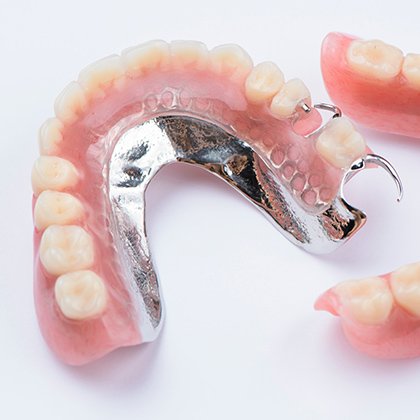 Partial dentures