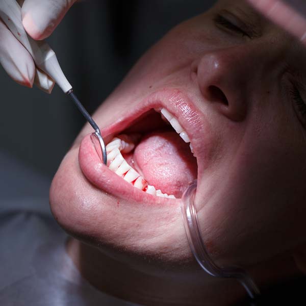 person having gum treatment