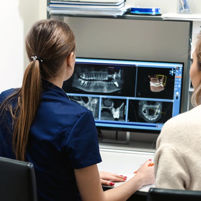 dental implants prep