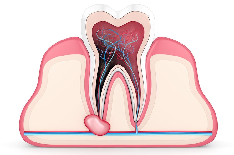 Cross section of the interior of a tooth