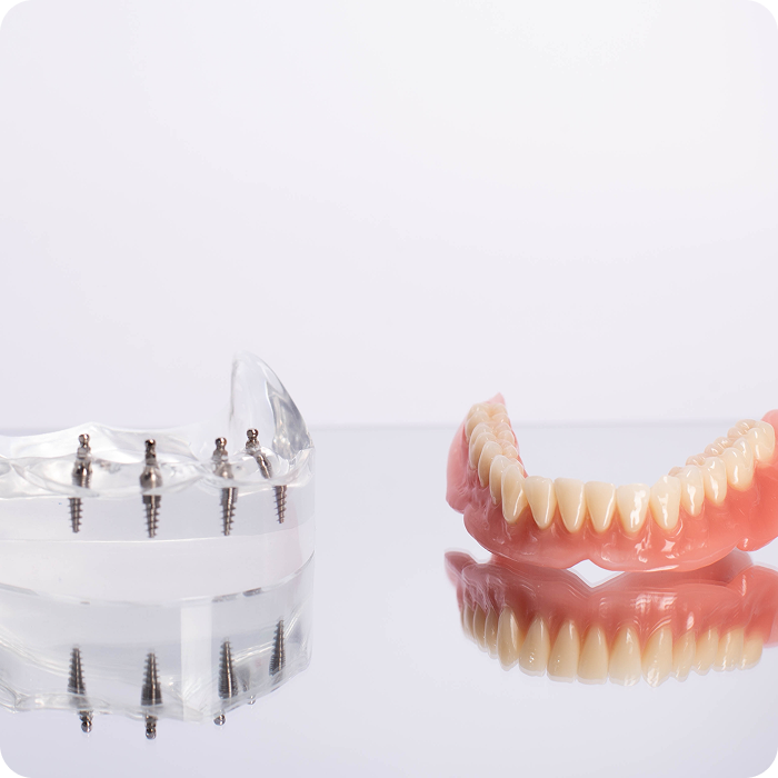 Implant denture