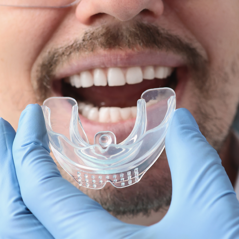 a mouthguard