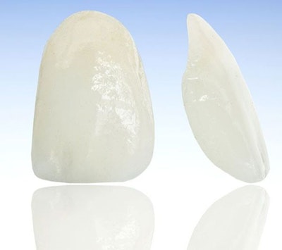 veneers
