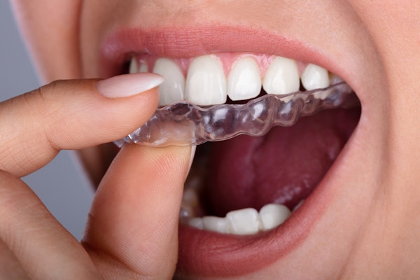 Person placing clear aligner over teeth