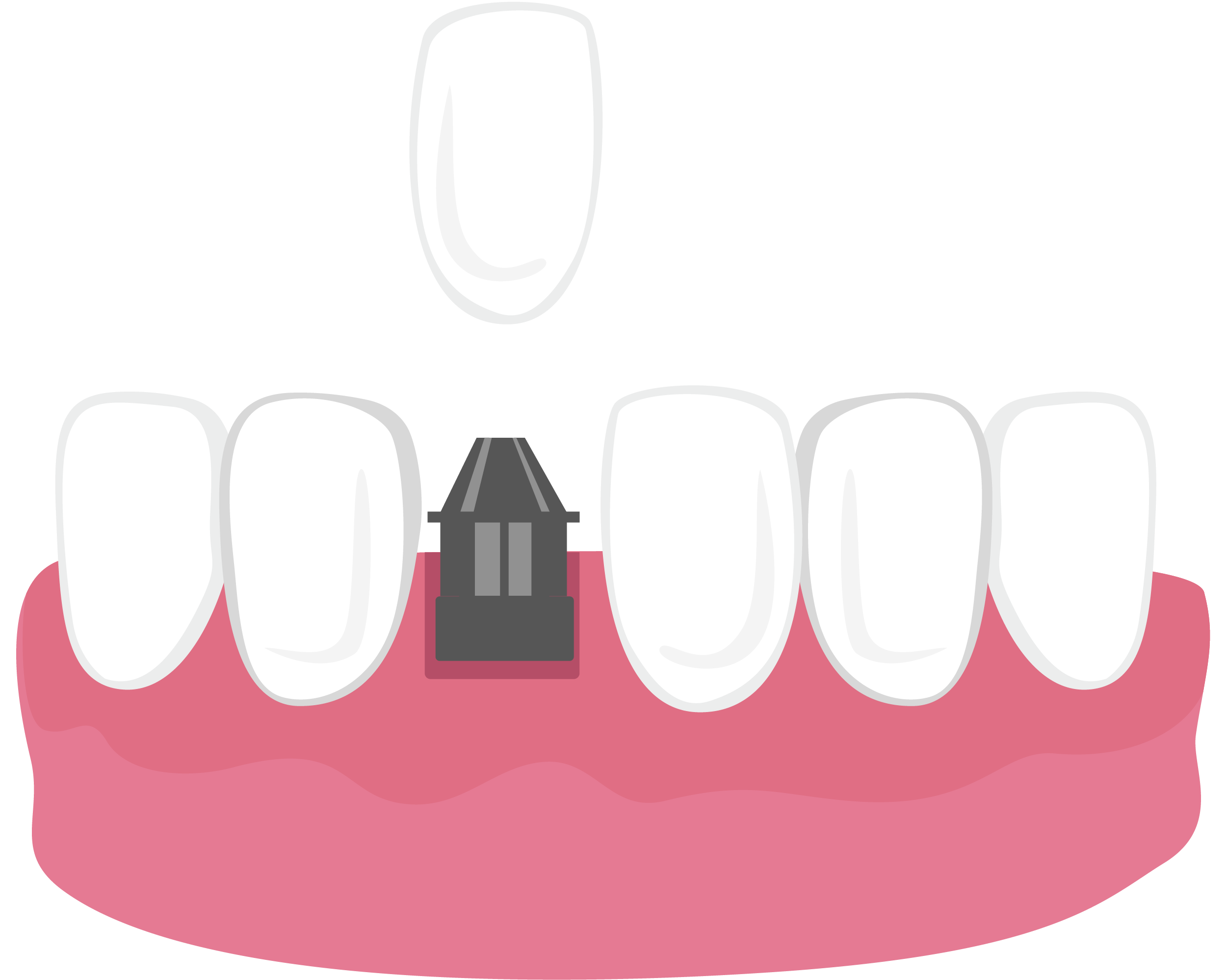 single tooth