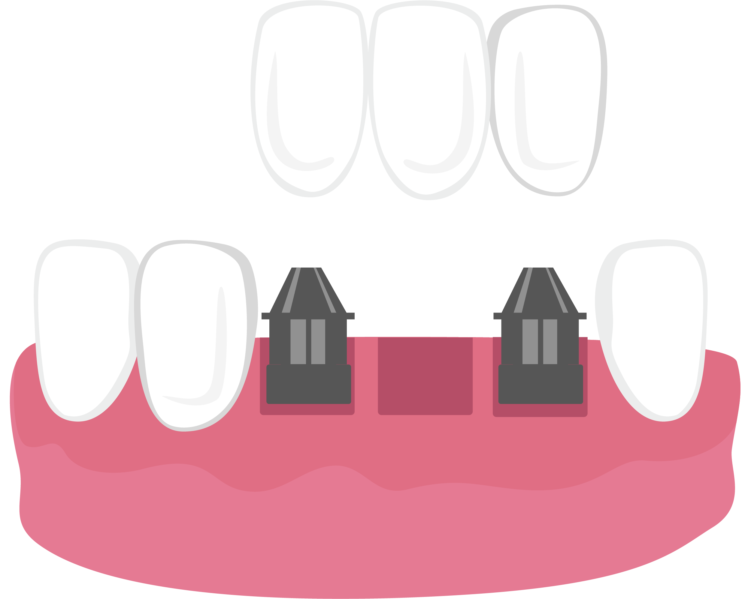 several teeth