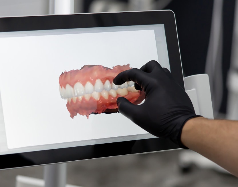dental arch model on a screen