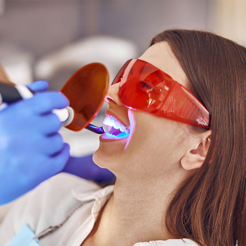 Dentist using UV light to set bonding agent on female patient