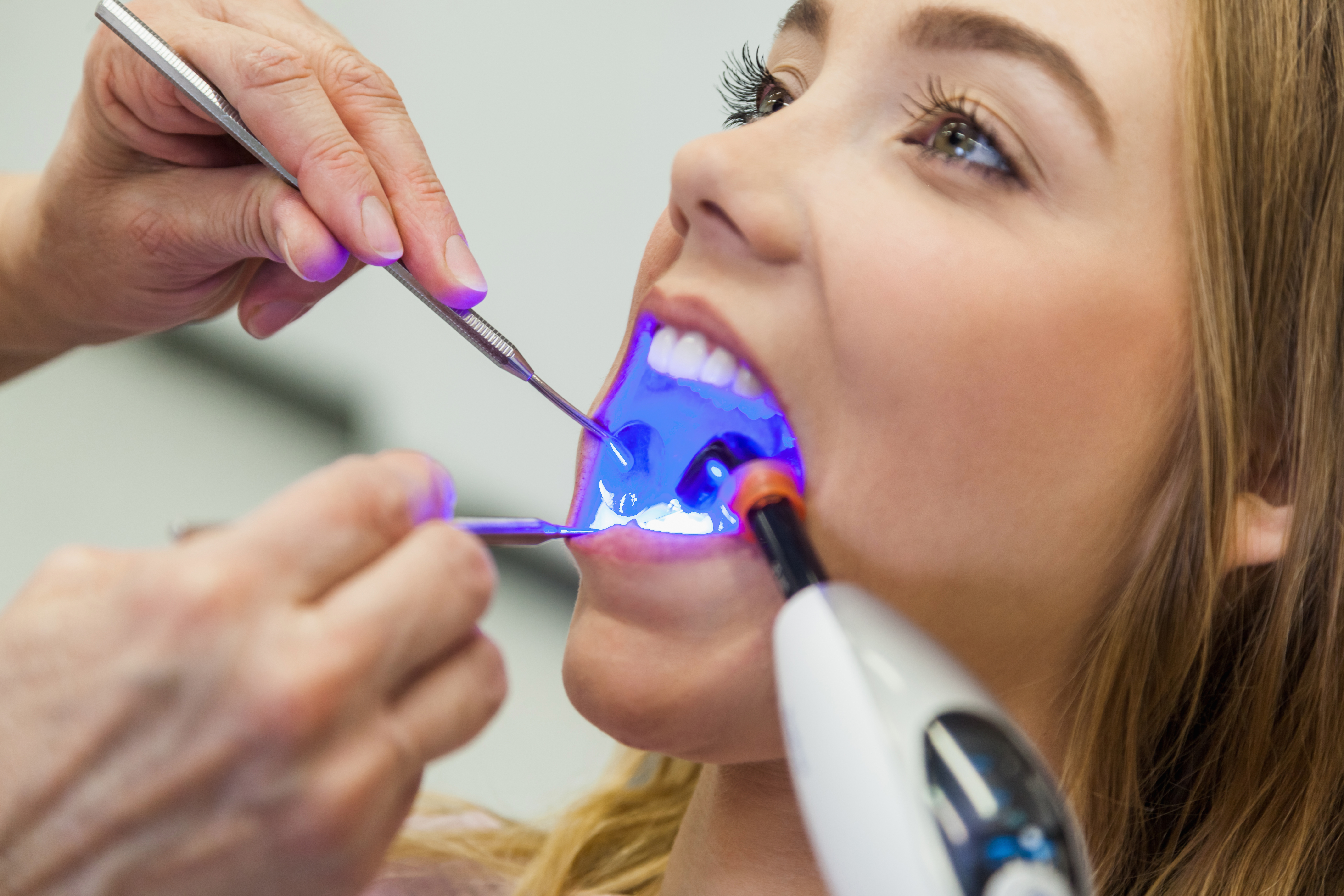 Teen getting a tooth-colored filling