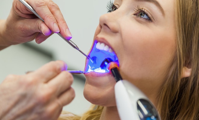 Teen getting a tooth-colored filling