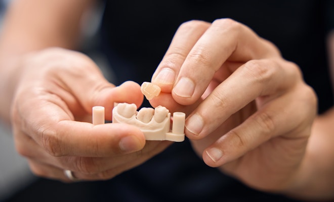 dentist placing crown on a dental model