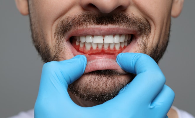 close-up of man's red gums
