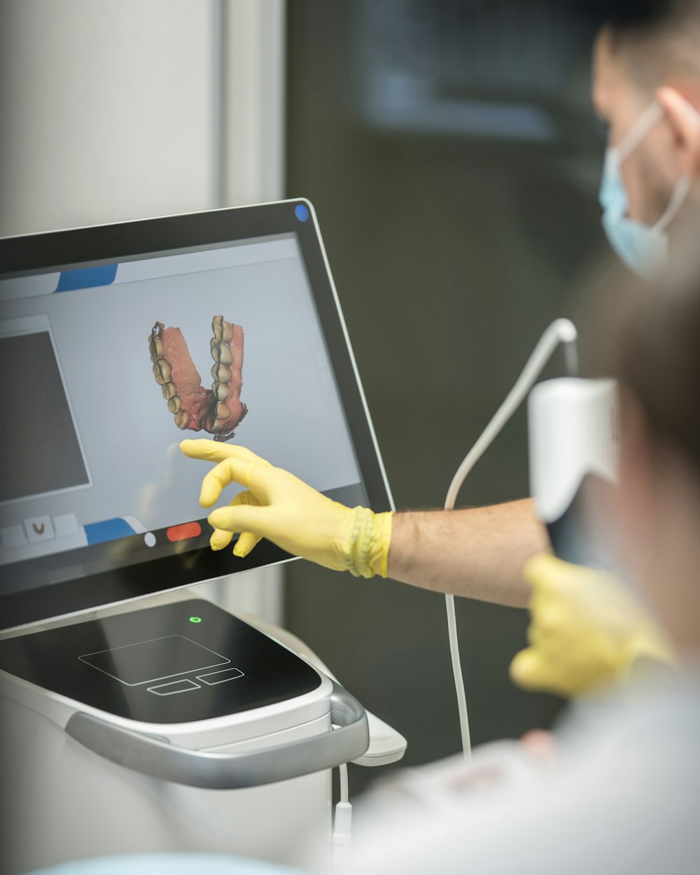 Digital dental impressions