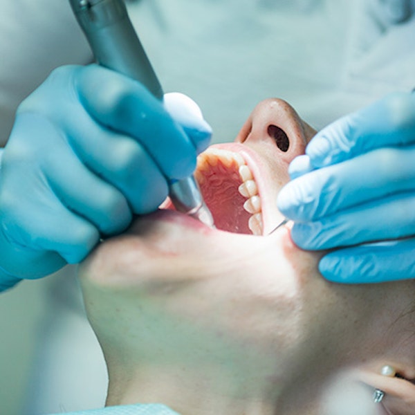 Why Dental Implants Are Better Than Other Tooth Repair » St. Louis