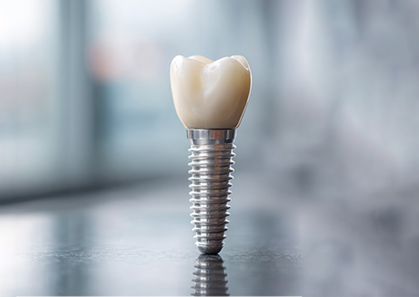 dental implant model