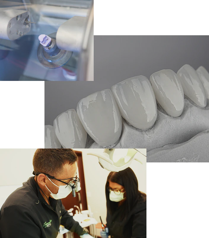 CEREC milling technology, porcelain veneer shells, and a Signature Dental dentist performing a patient exam