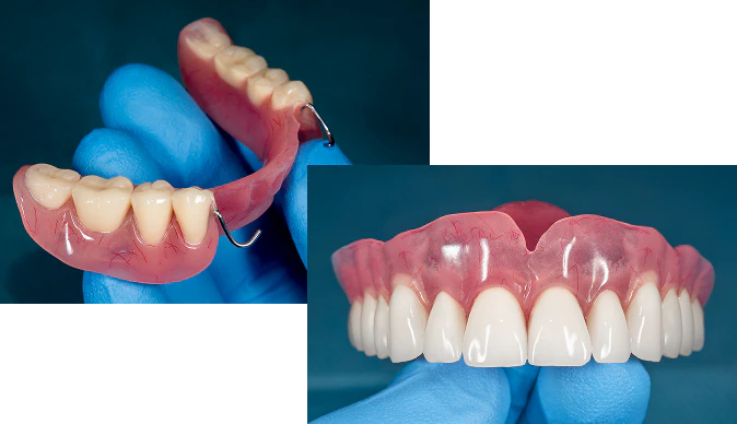 Two dental prosthetics held by gloved hands, including a partial denture with a metal clasp and a full denture