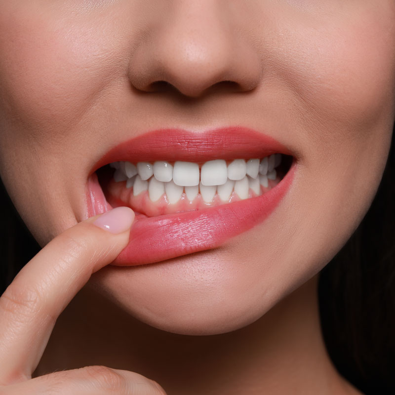 Woman pointing at her gums