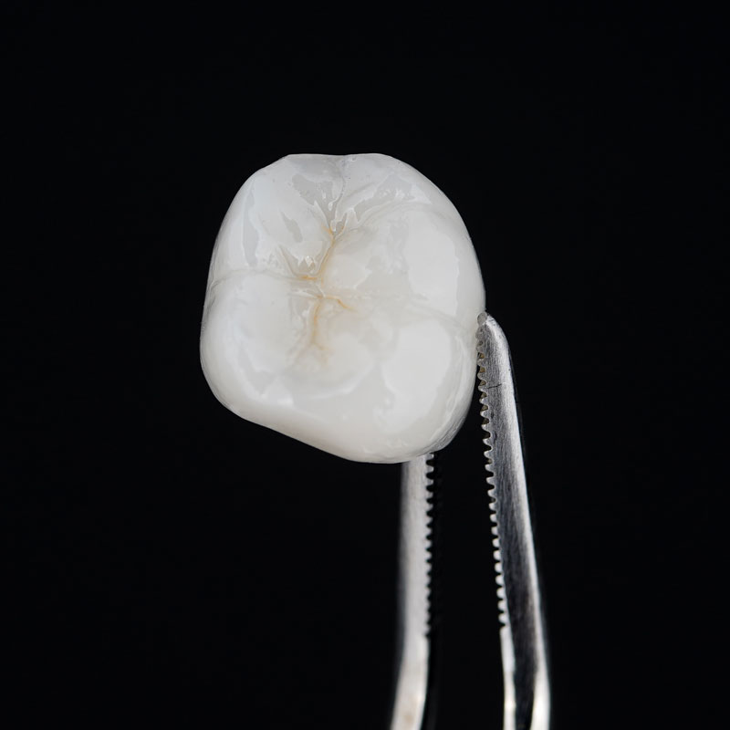 Dental Crown