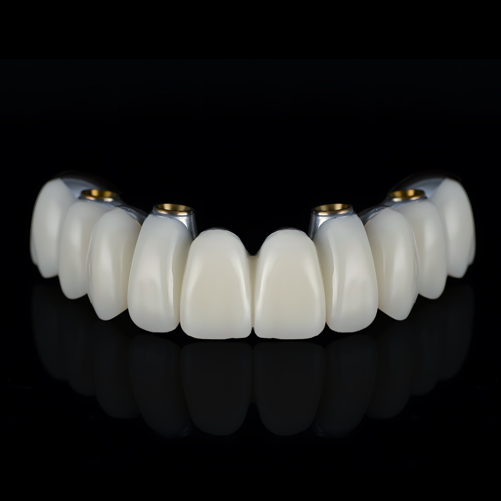 All-on-4 dentures