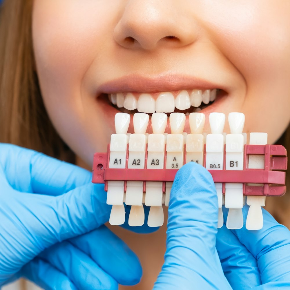 close-up of veneers next to a smile