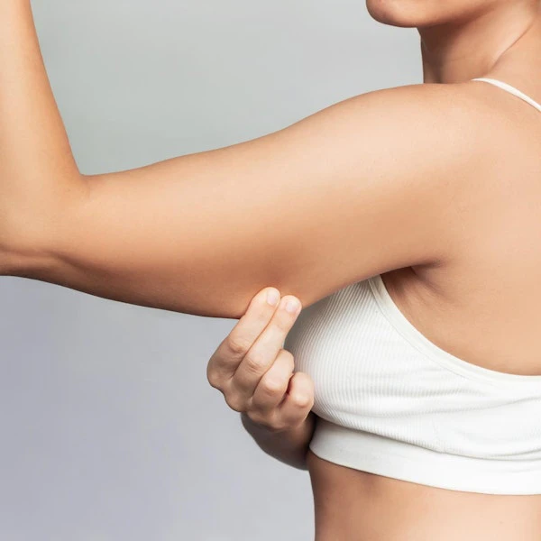 Woman pinching skin on upper arm