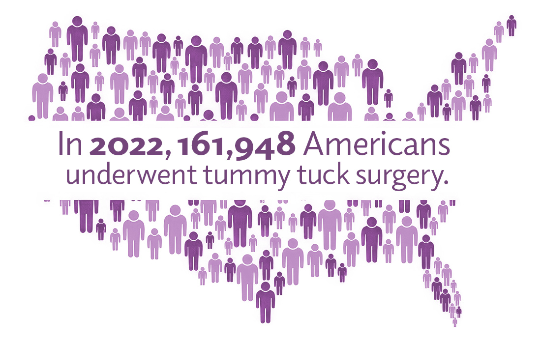 In 2022, 161,948 Americans underwent tummy tuck surgery.