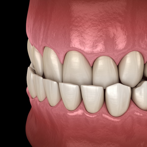Lower Jaw Illustration