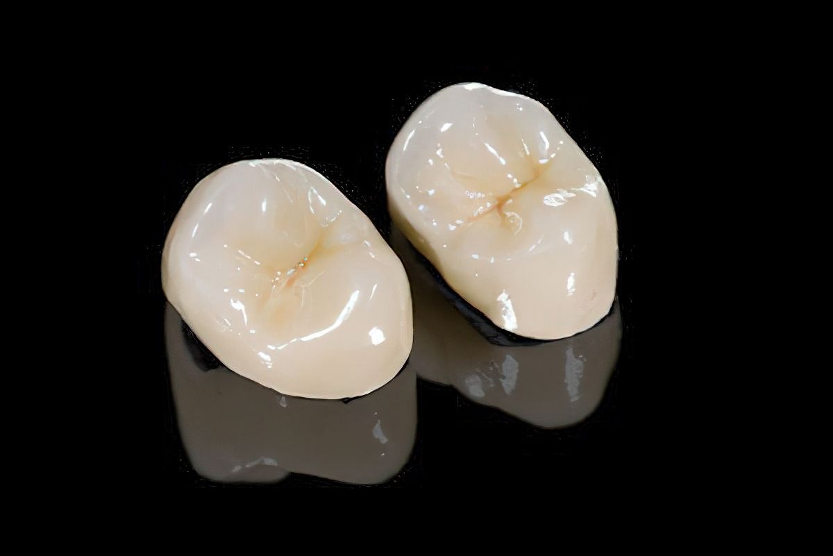 dental crowns