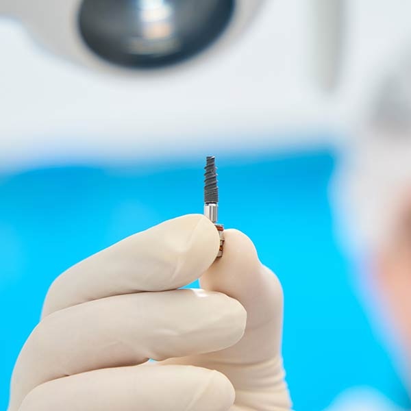 Dental implant
