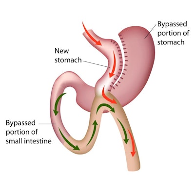 Diagram of Omega Loop