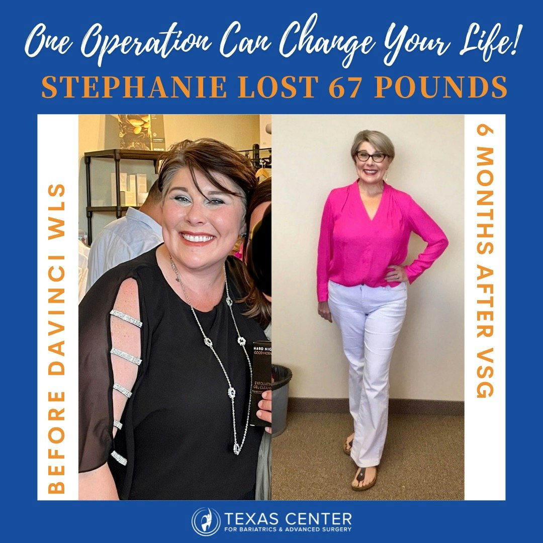 Weight Loss Surgery Dallas Tx  : Transform Your Life