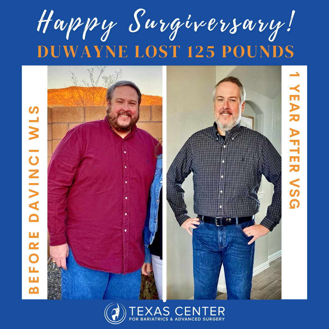 weight loss surgery before and after with dr joe cribbins in plano tx using the ultra minimally invasive davinci robotic surgical system