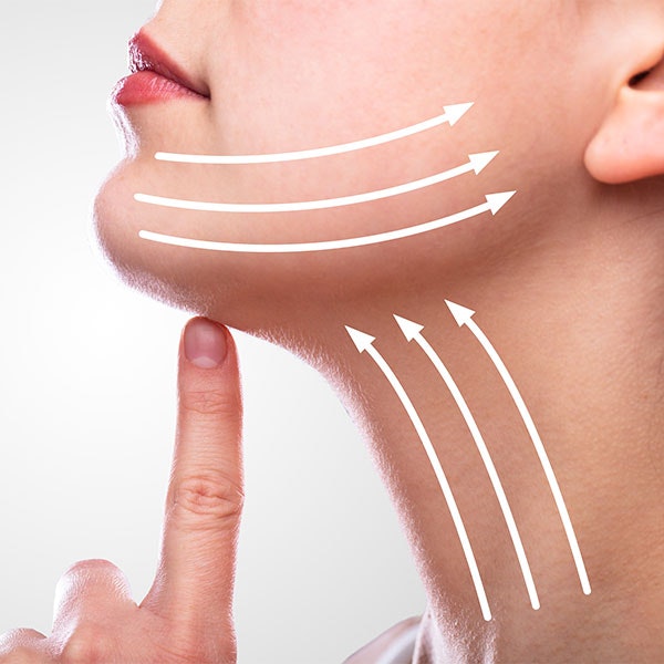 neck lift