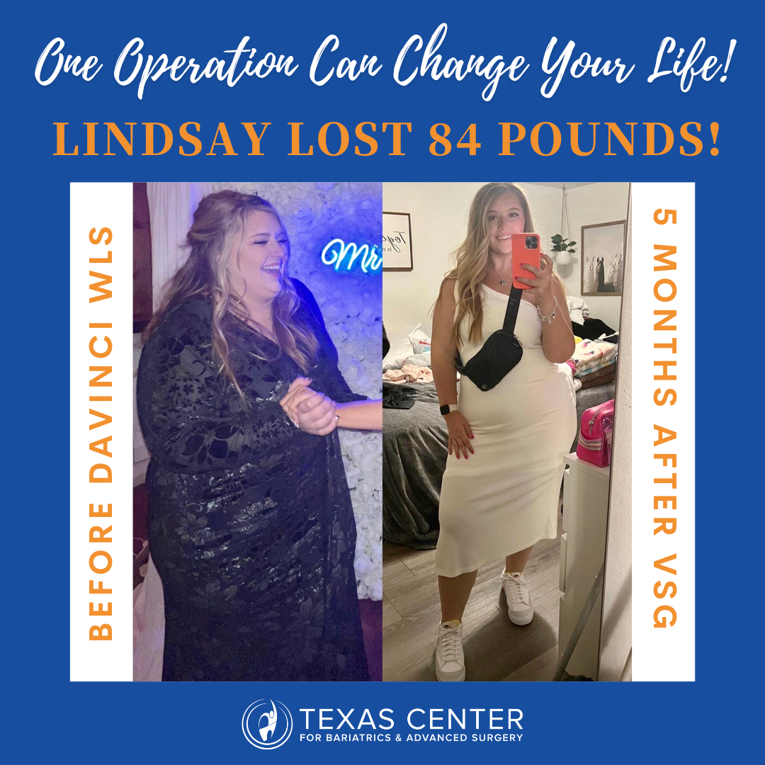 Everything You Need to Know About Using Your FSA or HSA to Pay for Weight  Loss Surgery - Texas Bariatric Weight Loss Surgery Center