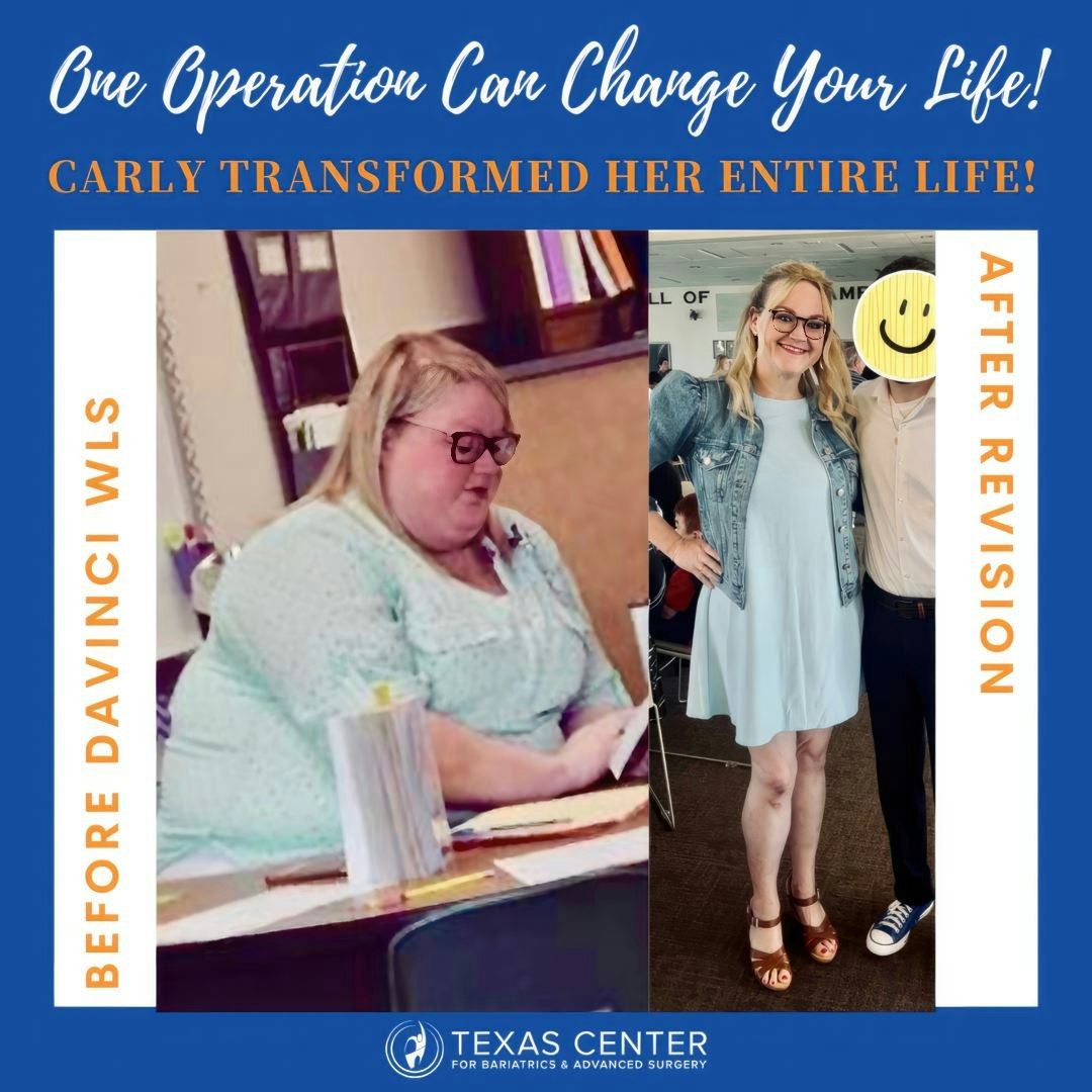 Carly's before and after